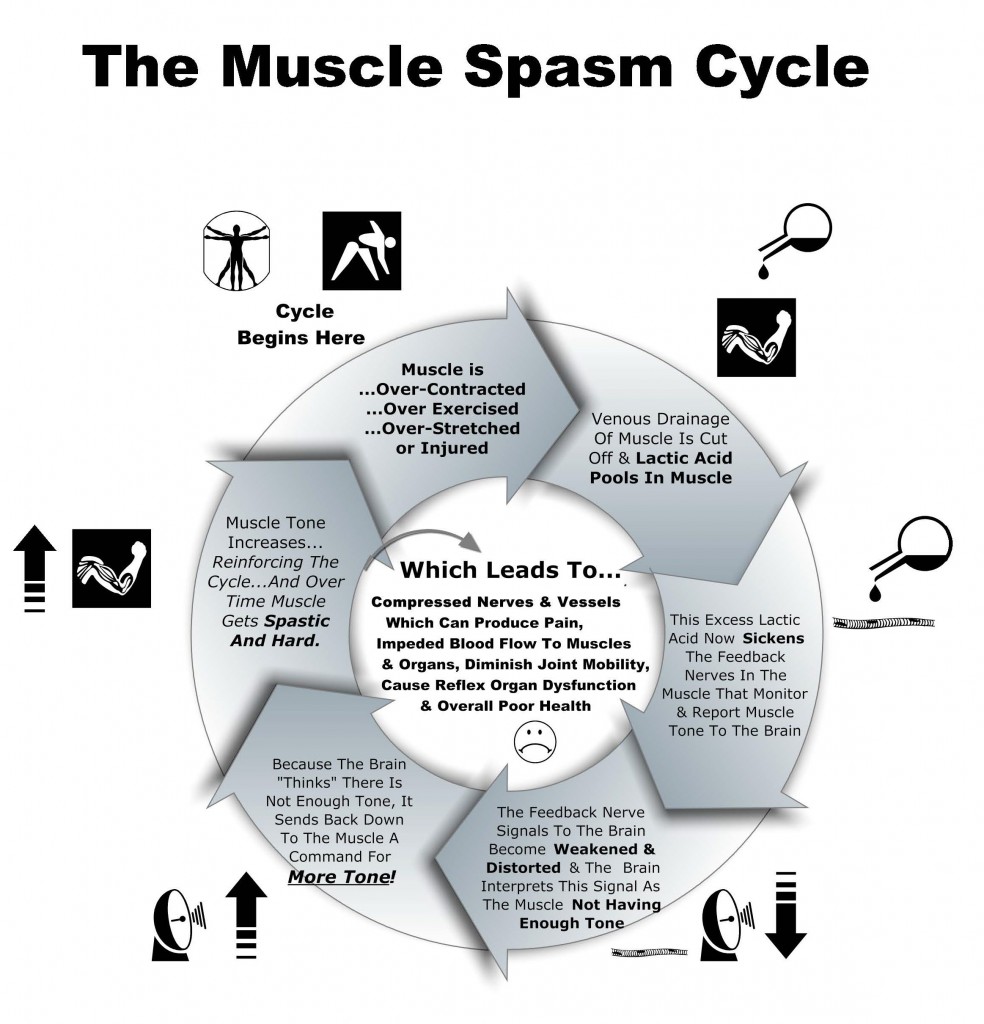 Muscle Spasm Cycle Chart